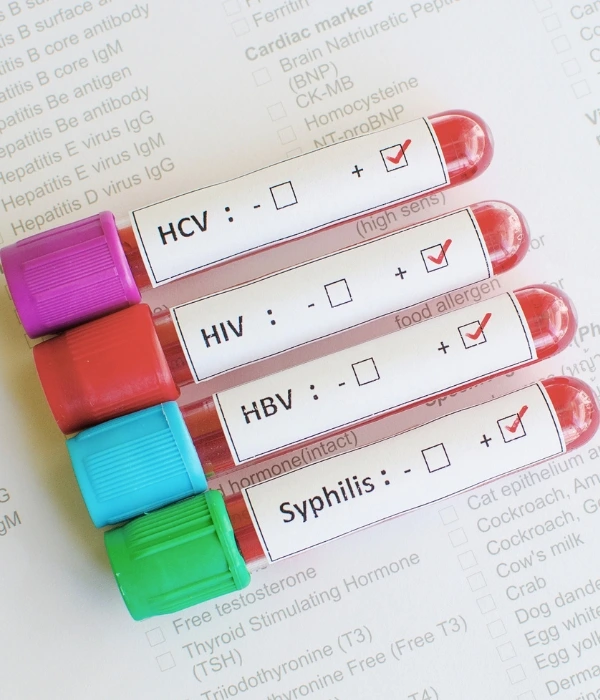 Enfermedades de transmisión sexual Ginecóloga en Colima