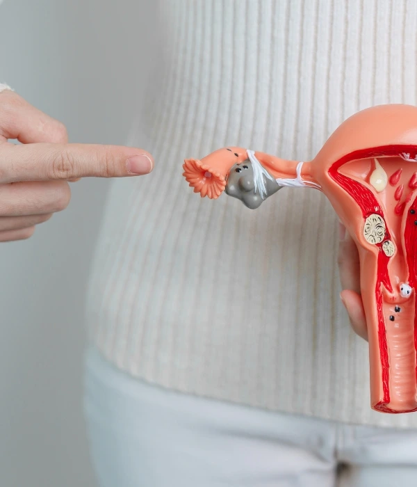 Poliquistosis Ovárica Ginecóloga en Colima