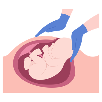cesarea Ginecología y Obstetricia en Colima