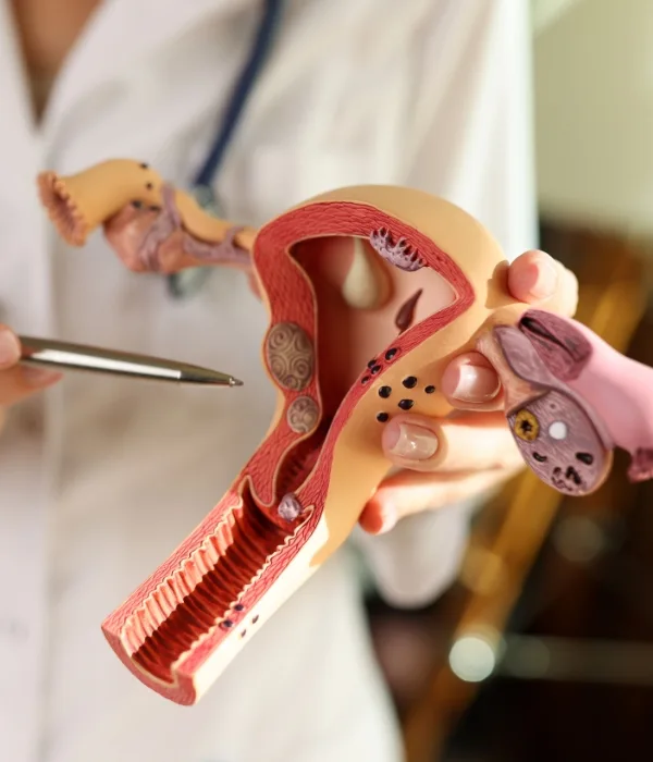 chekup Check Up Ginecológico en Colima