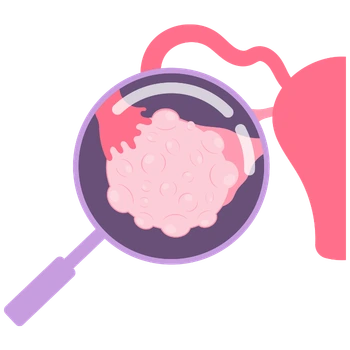 ovario poliquistico Ginecología y Obstetricia en Colima