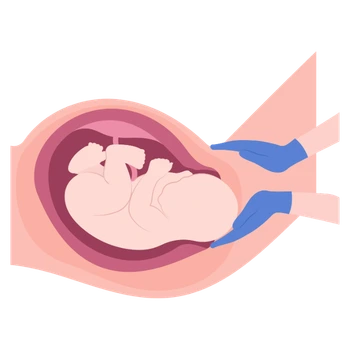 parto Ginecología y Obstetricia en Colima